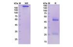 CD100 (SEMA4D) (Pepinemab Biosimilar) Antibody in SDS-PAGE (SDS-PAGE)