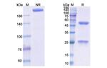 Obiltoxaximab Chimeric Antibody in SDS-PAGE (SDS-PAGE)