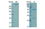 Navivumab Recombinant Human Monoclonal Antibody