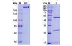 Inebilizumab Humanized Antibody in SDS-PAGE (SDS-PAGE)