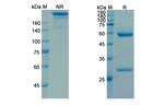 Pamrevlumab Recombinant Human Monoclonal Antibody