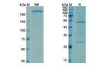 LINGO1 (Opicinumab Biosimilar) Antibody in SDS-PAGE (SDS-PAGE)