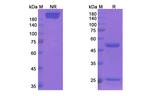 MUC1 (Clivatuzumab Biosimilar) Recombinant Humanized mouse Monoclonal Antibody