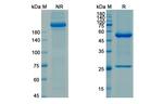 Ascrinvacumab Antibody in SDS-PAGE (SDS-PAGE)