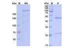 Bleselumab Antibody in SDS-PAGE (SDS-PAGE)
