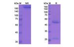 Plozalizumab Humanized Antibody in SDS-PAGE (SDS-PAGE)