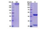 Risankizumab Humanized Antibody in SDS-PAGE (SDS-PAGE)