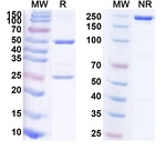 TSLP (Tezepelumab Biosimilar) Antibody in SDS-PAGE (SDS-PAGE)