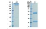 Rinucumab Recombinant Human Monoclonal Antibody