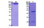 Afasevikumab Antibody in SDS-PAGE (SDS-PAGE)
