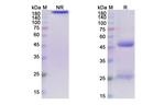 Tilavonemab Chimeric Antibody in SDS-PAGE (SDS-PAGE)