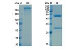 CSF1R (CD115) (Cabiralizumab Biosimilar) Antibody in SDS-PAGE (SDS-PAGE)
