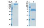 IGF1/IGF2 (Xentuzumab Biosimilar) Antibody in SDS-PAGE (SDS-PAGE)