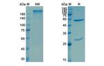 Enoblituzumab Humanized Antibody in SDS-PAGE (SDS-PAGE)