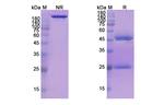 Refanezumab Humanized Antibody in SDS-PAGE (SDS-PAGE)