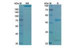 Mirvetuximab Chimeric Antibody in SDS-PAGE (SDS-PAGE)