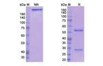 Crotedumab Recombinant Human Monoclonal Antibody