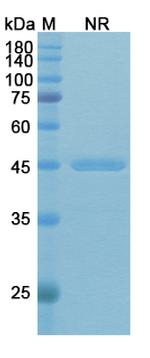 Rivabazumab Humanized Recombinant Human Monoclonal Antibody