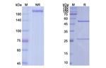 Navicixizumab Chimeric Antibody in SDS-PAGE (SDS-PAGE)