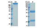 Prezalumab Antibody in SDS-PAGE (SDS-PAGE)