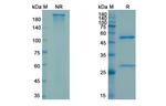 Carotuximab Chimeric Antibody in SDS-PAGE (SDS-PAGE)