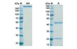 Timolumab Recombinant Human Monoclonal Antibody