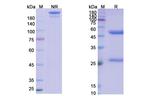 Plasma Kallikrein (Lanadelumab Biosimilar) Recombinant Human Monoclonal Antibody