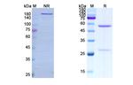 Vonlerolizumab Humanized Recombinant Human Monoclonal Antibody
