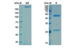 Galcanezumab Humanized Antibody in SDS-PAGE (SDS-PAGE)