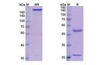 Domagrozumab Humanized Recombinant Human Monoclonal Antibody