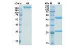 Birtamimab Chimeric Recombinant Human Monoclonal Antibody