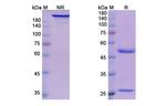 Suptavumab Antibody in SDS-PAGE (SDS-PAGE)