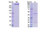Setrusumab Antibody in SDS-PAGE (SDS-PAGE)