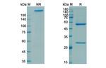 Rozanolixizumab Chimeric Recombinant Human Monoclonal Antibody