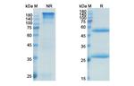 Lupartumab Antibody in SDS-PAGE (SDS-PAGE)