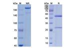 Burosumab Recombinant Human Monoclonal Antibody