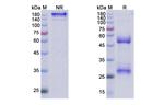 Calcitonin/CALCB (Eptinezumab Biosimilar) Recombinant Humanized mouse Monoclonal Antibody