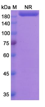 Lutikizumab Humanized Antibody in SDS-PAGE (SDS-PAGE)