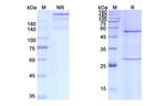 Serum Amyloid P (Dezamizumab Biosimilar) Recombinant Humanized mouse Monoclonal Antibody