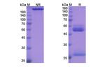 Aprutumab Recombinant Human Monoclonal Antibody