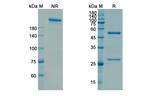 4-1BB (CD137) (Utomilumab Biosimilar) Antibody in SDS-PAGE (SDS-PAGE)
