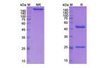 Vunakizumab Humanized Antibody in SDS-PAGE (SDS-PAGE)
