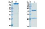 Rosmantuzumab Humanized Recombinant Human Monoclonal Antibody