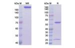 Sacituzumab Humanized Antibody in SDS-PAGE (SDS-PAGE)