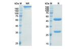 Ranevetmab Antibody in SDS-PAGE (SDS-PAGE)