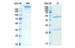 Brazikumab Antibody in SDS-PAGE (SDS-PAGE)