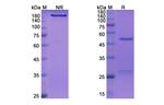 Crizanlizumab Humanized Antibody in SDS-PAGE (SDS-PAGE)