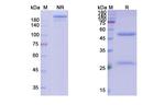Tomaralimab Chimeric Recombinant Human Monoclonal Antibody