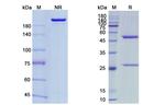 Maftivimab Recombinant Human Monoclonal Antibody