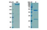 Activin A (Garetosmab Biosimilar) Recombinant Humanized mouse Monoclonal Antibody